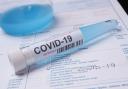 Coronavirus case rates remain high among younger age groups